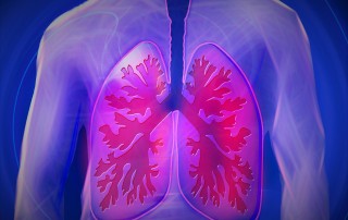 pulmonary arterial hypertension